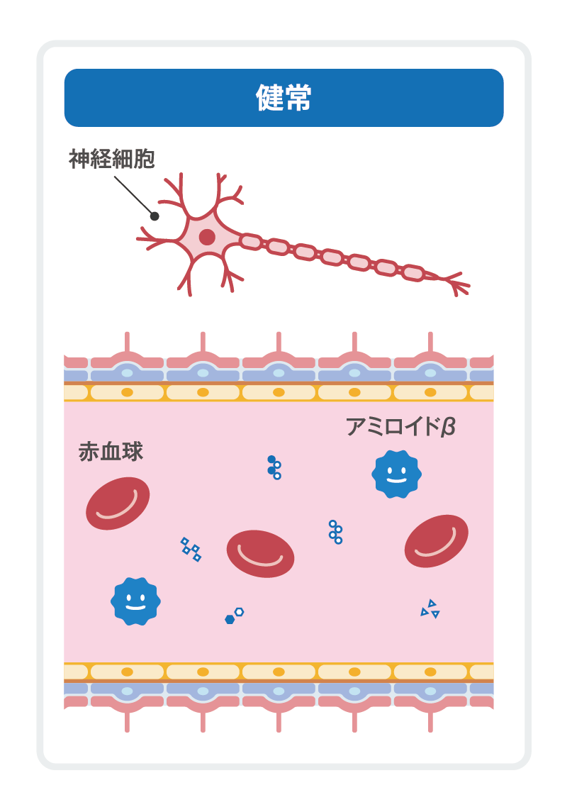mci図解2 